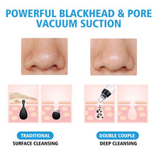 Load image into Gallery viewer, Facial Vacuum Blackhead Remover
