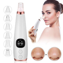 Load image into Gallery viewer, Facial Vacuum Blackhead Remover
