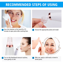 Load image into Gallery viewer, Facial Vacuum Blackhead Remover
